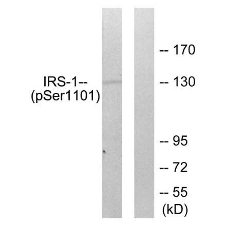 Western Blot - Anti-IRS-1 (phospho Ser1101) Antibody (A0446) - Antibodies.com