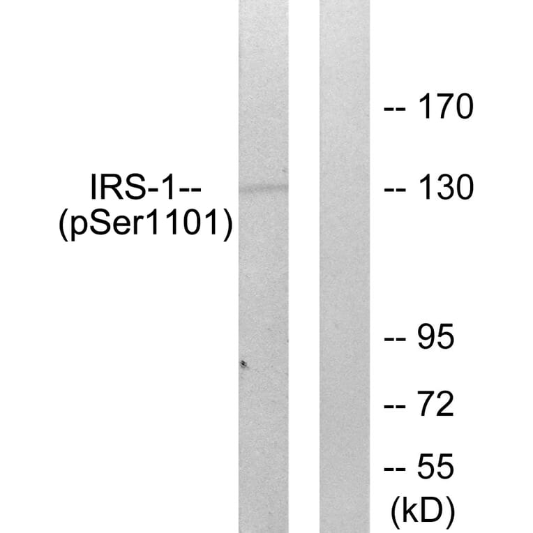 Western Blot - Anti-IRS-1 (phospho Ser1101) Antibody (A0446) - Antibodies.com