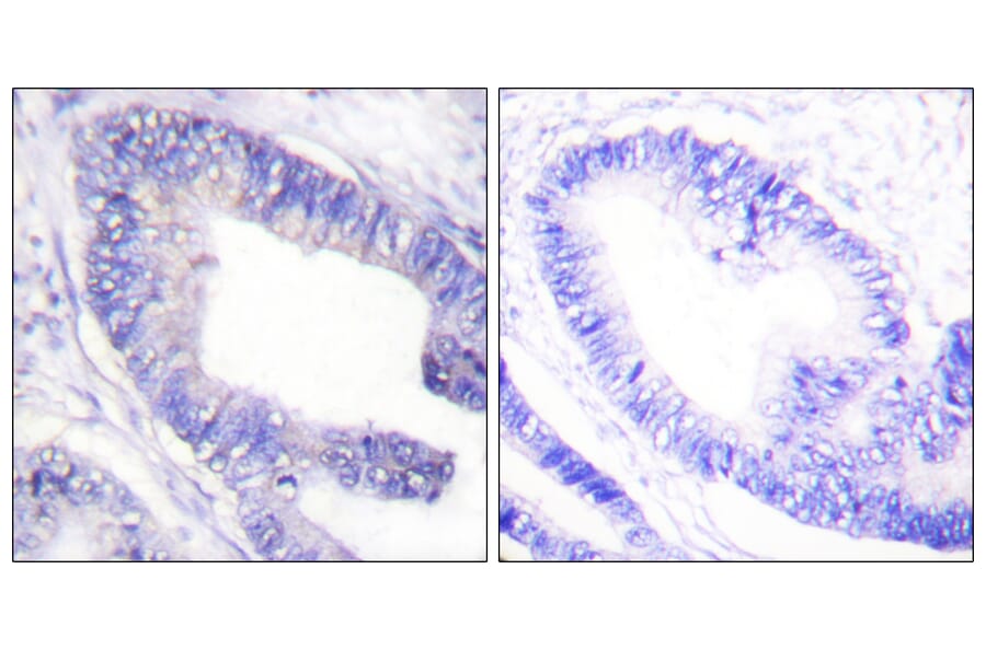 Immunohistochemistry - Anti-IRS-1 (phospho Ser1101) Antibody (A0446) - Antibodies.com