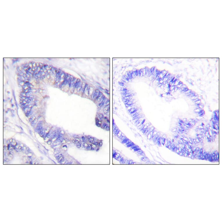 Immunohistochemistry - Anti-IRS-1 (phospho Ser1101) Antibody (A0446) - Antibodies.com