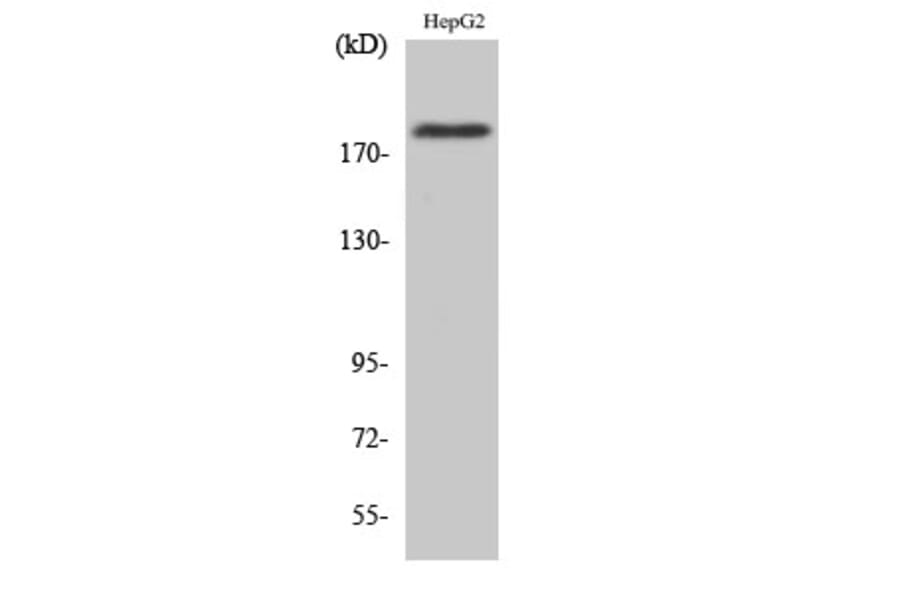 Western Blot - Anti-IRS-1 (phospho Ser1101) Antibody (A0446) - Antibodies.com