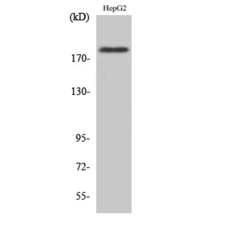 Western Blot - Anti-IRS-1 (phospho Ser1101) Antibody (A0446) - Antibodies.com