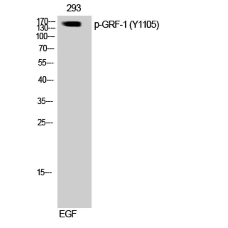 Western Blot - Anti-GRF-1 (phospho Tyr1105) Antibody (A0433) - Antibodies.com