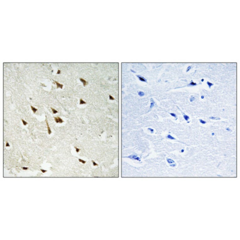 Immunohistochemistry - Anti-GRF-1 (phospho Tyr1105) Antibody (A0433) - Antibodies.com