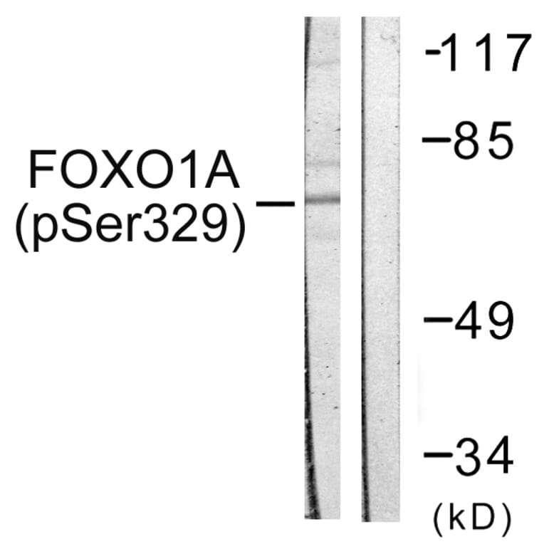 Western Blot - Anti-FOXO1A (phospho Ser329) Antibody (A0484) - Antibodies.com