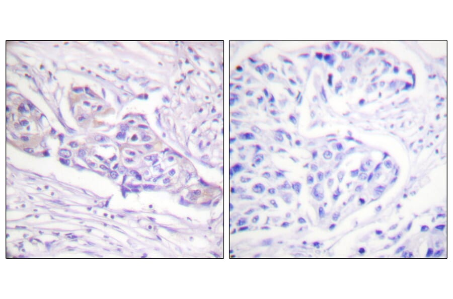 Immunohistochemistry - Anti-FOXO1A (phospho Ser329) Antibody (A0484) - Antibodies.com