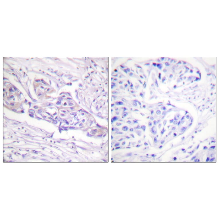 Immunohistochemistry - Anti-FOXO1A (phospho Ser329) Antibody (A0484) - Antibodies.com