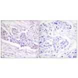 Immunohistochemistry - Anti-FOXO1A (phospho Ser329) Antibody (A0484) - Antibodies.com