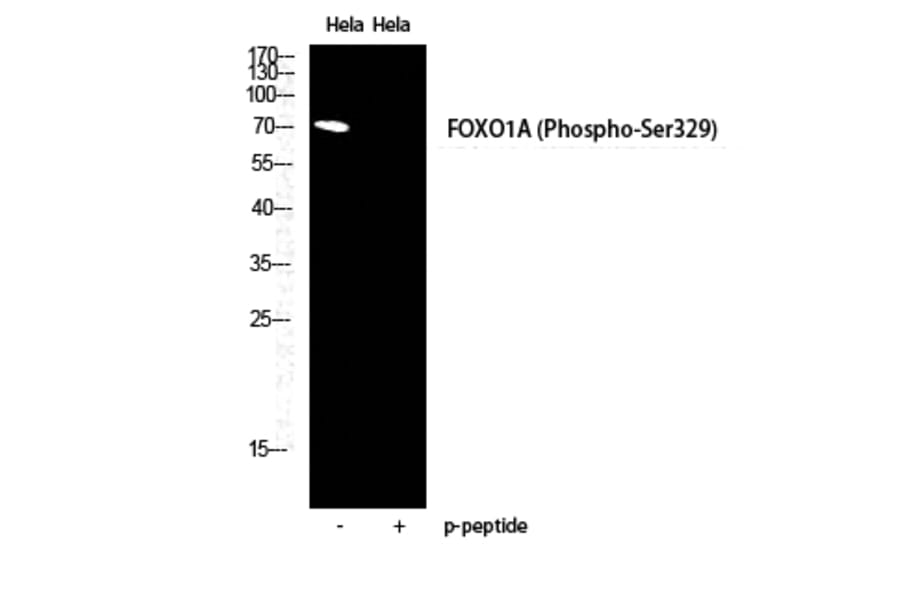 Western Blot - Anti-FOXO1A (phospho Ser329) Antibody (A0484) - Antibodies.com