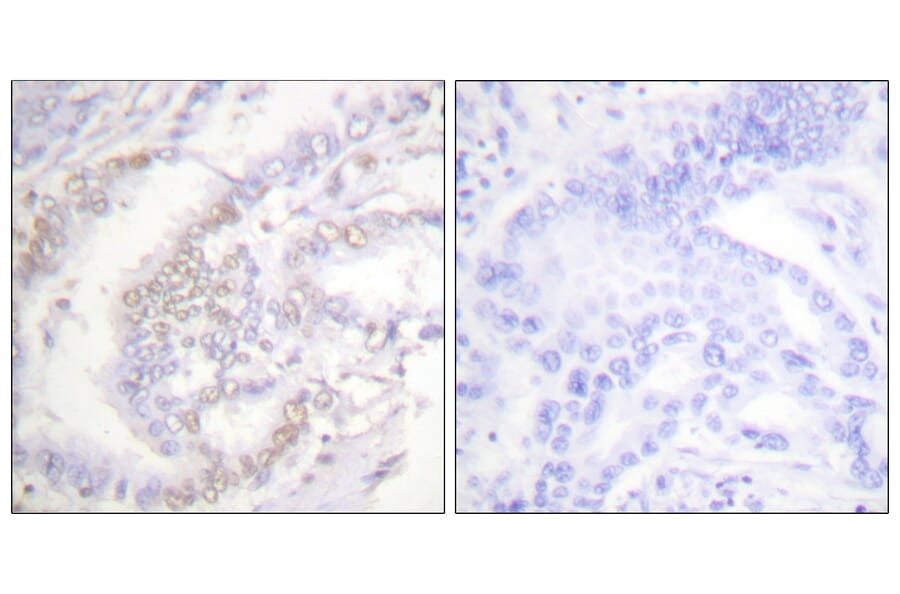 Immunohistochemistry - Anti-FANCD2 (phospho Ser222) Antibody (A0427) - Antibodies.com