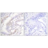 Immunohistochemistry - Anti-FANCD2 (phospho Ser222) Antibody (A0427) - Antibodies.com