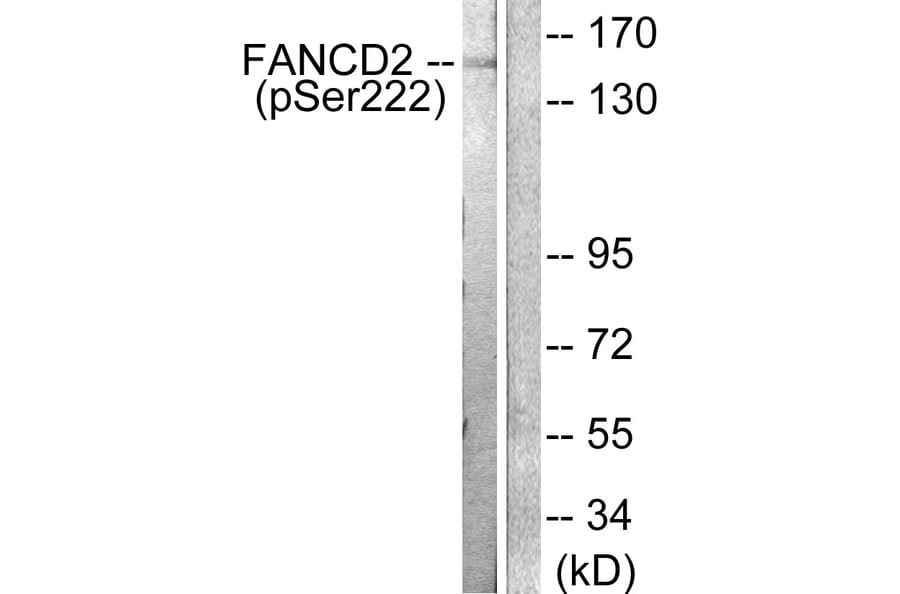 Western Blot - Anti-FANCD2 (phospho Ser222) Antibody (A0427) - Antibodies.com