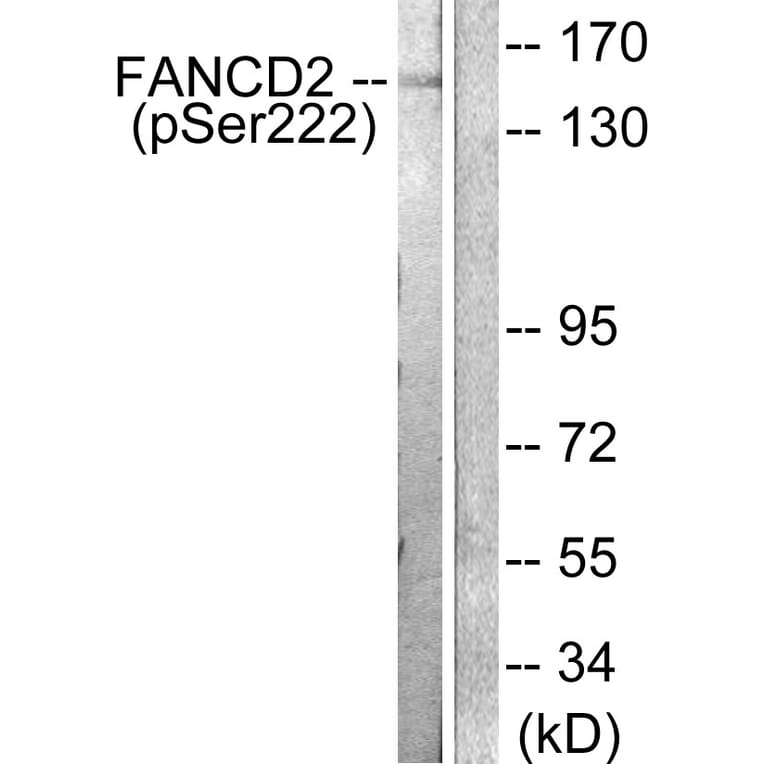 Western Blot - Anti-FANCD2 (phospho Ser222) Antibody (A0427) - Antibodies.com