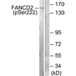 Western Blot - Anti-FANCD2 (phospho Ser222) Antibody (A0427) - Antibodies.com