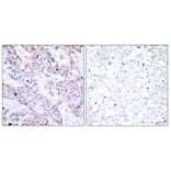 Immunohistochemistry - Anti-Estrogen Receptor-alpha Antibody (B7076) - Antibodies.com