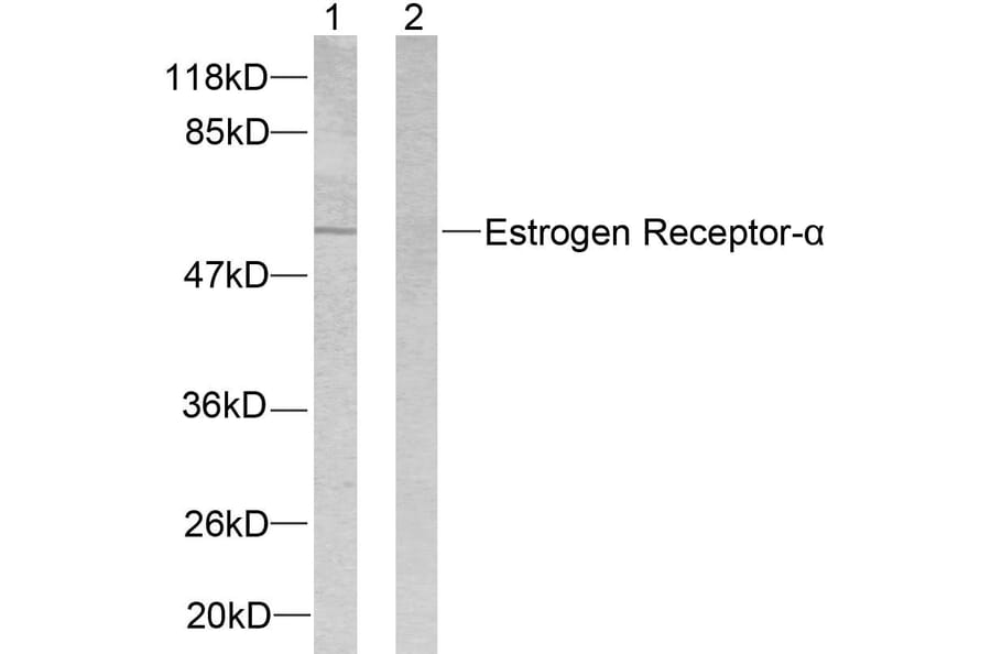 Western Blot - Anti-Estrogen Receptor-alpha Antibody (B7075) - Antibodies.com
