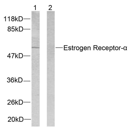 Western Blot - Anti-Estrogen Receptor-alpha Antibody (B7075) - Antibodies.com