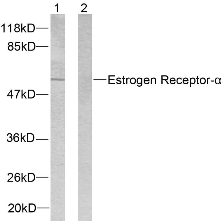 Western Blot - Anti-Estrogen Receptor-alpha Antibody (B7075) - Antibodies.com