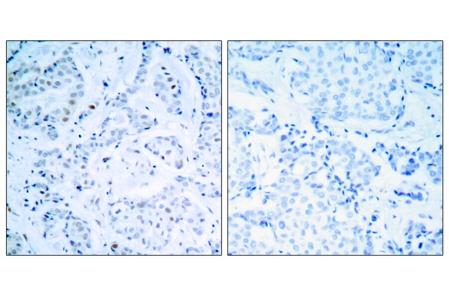 Immunohistochemistry - Anti-Estrogen Receptor-alpha Antibody (B7075) - Antibodies.com