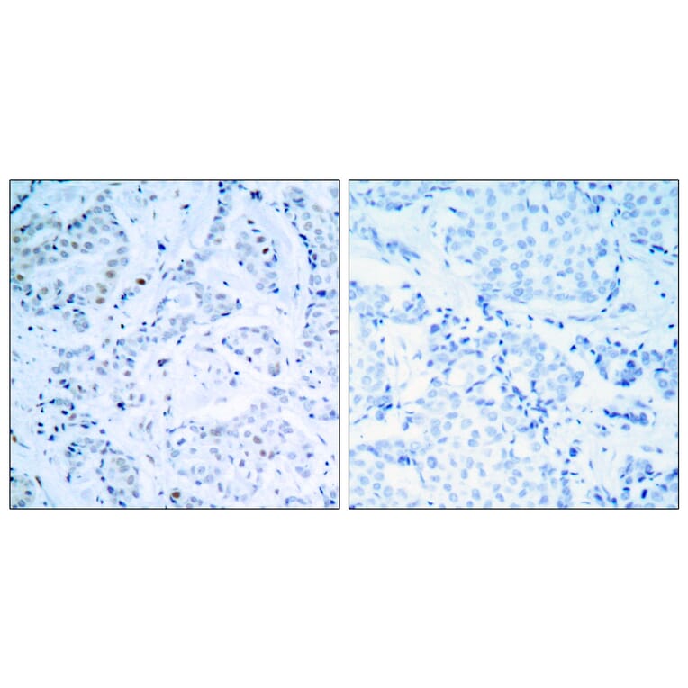 Immunohistochemistry - Anti-Estrogen Receptor-alpha Antibody (B7075) - Antibodies.com