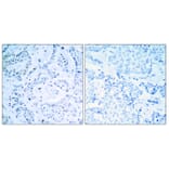Immunohistochemistry - Anti-Estrogen Receptor-alpha Antibody (B7075) - Antibodies.com