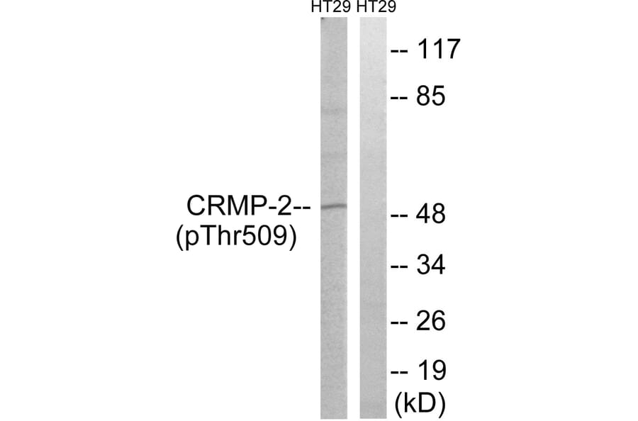 Western Blot - Anti-CRMP-2 (phospho Thr509) Antibody (A8324) - Antibodies.com