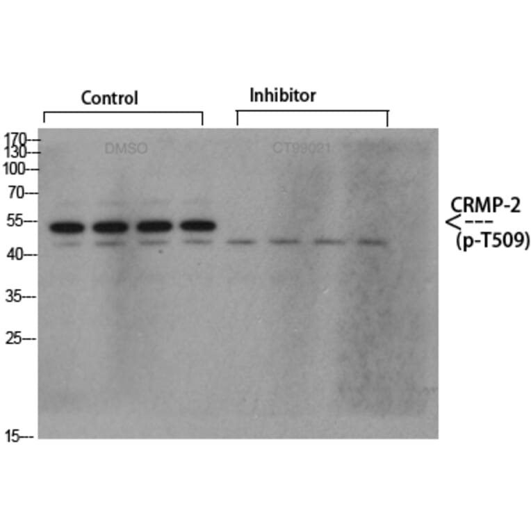 Western Blot - Anti-CRMP-2 (phospho Thr509) Antibody (A8324) - Antibodies.com