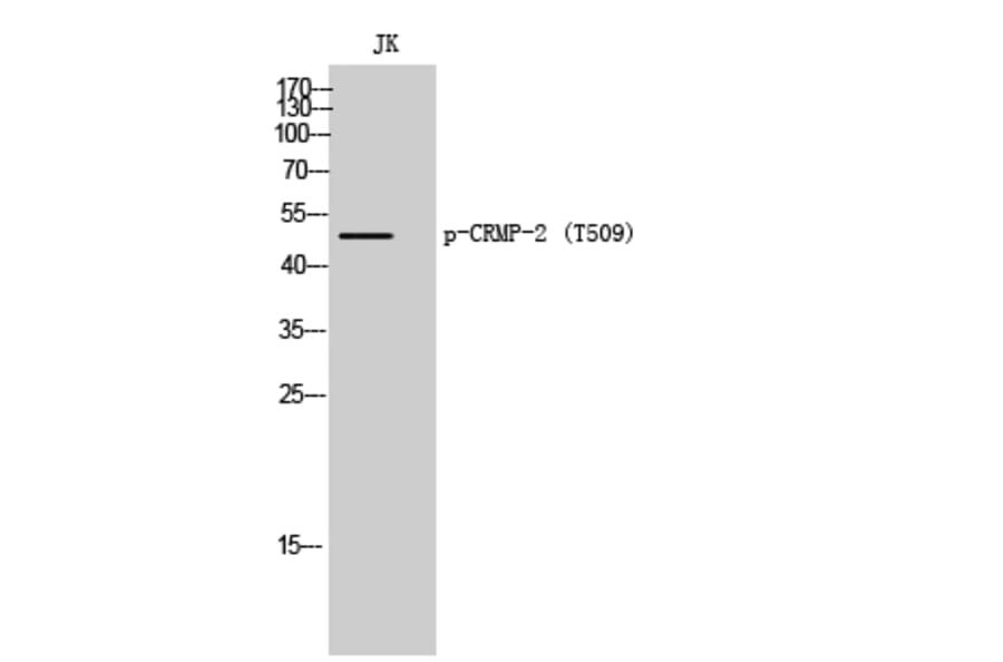 Western Blot - Anti-CRMP-2 (phospho Thr509) Antibody (A8324) - Antibodies.com