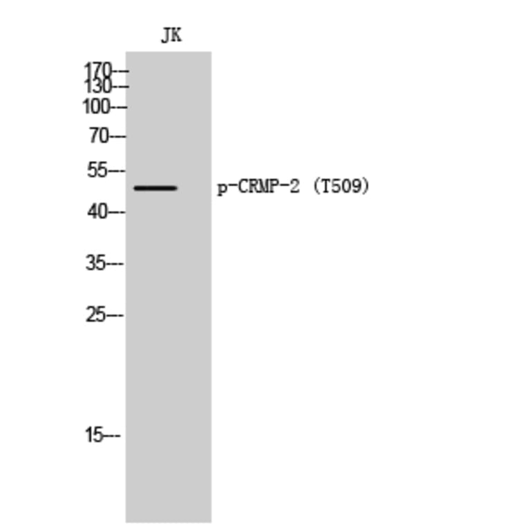 Western Blot - Anti-CRMP-2 (phospho Thr509) Antibody (A8324) - Antibodies.com