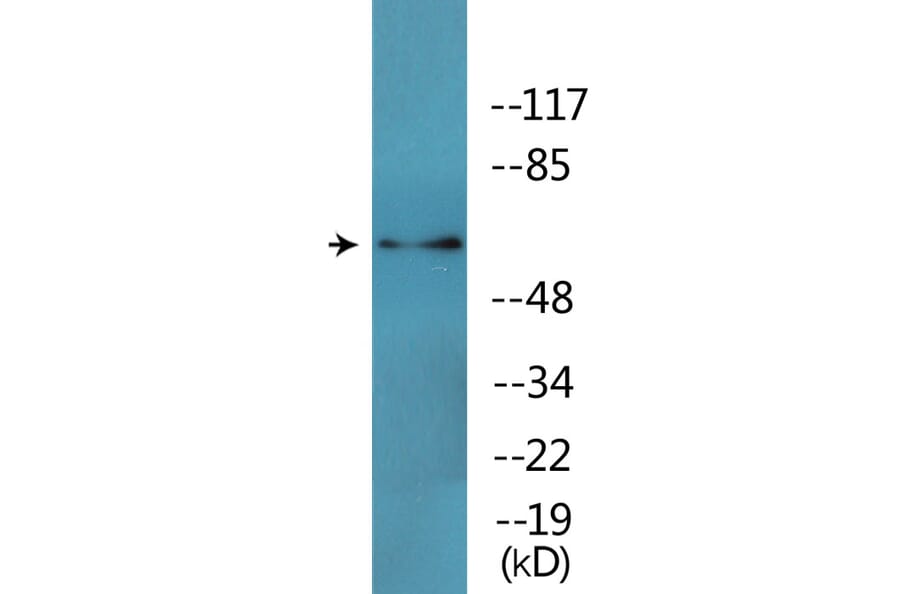 Western Blot - Anti-CRMP-2 (phospho Thr509) Antibody (P12-1094) - Antibodies.com