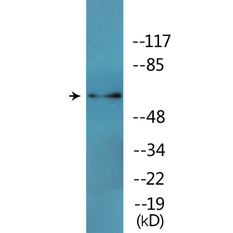 Western Blot - Anti-CRMP-2 (phospho Thr509) Antibody (P12-1094) - Antibodies.com