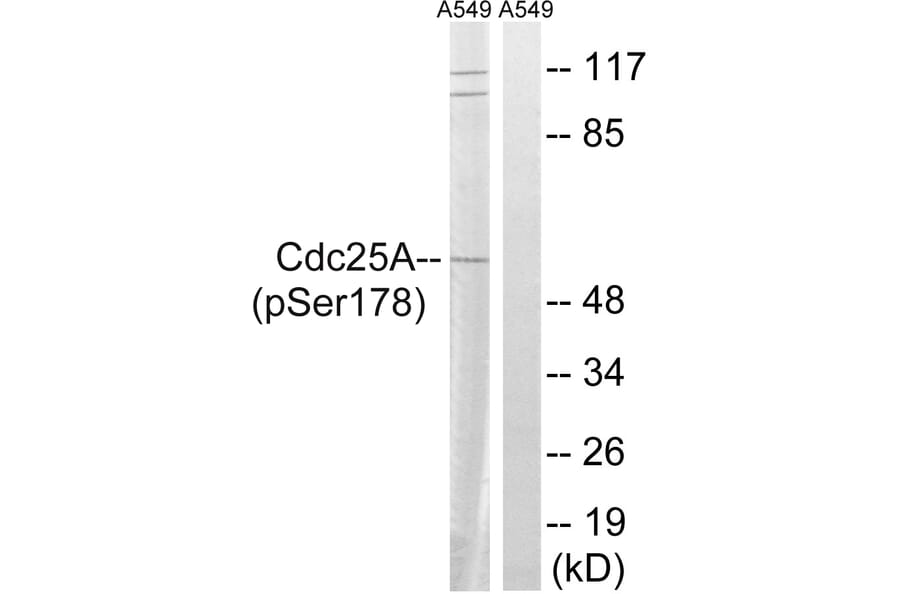 Western Blot - Anti-CDC25A (phospho Ser178) Antibody (A8017) - Antibodies.com