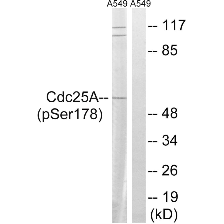 Western Blot - Anti-CDC25A (phospho Ser178) Antibody (A8017) - Antibodies.com