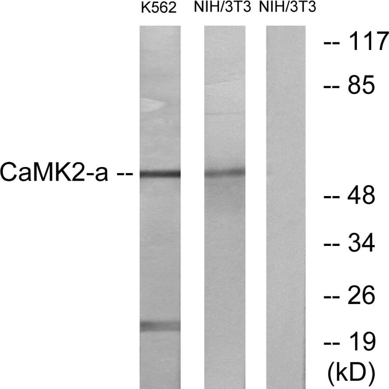 Western Blot - Anti-CaMK2 alpha + delta Antibody (B7033) - Antibodies.com