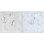 Immunohistochemistry - Anti-CaMK2 alpha + delta Antibody (B7033) - Antibodies.com