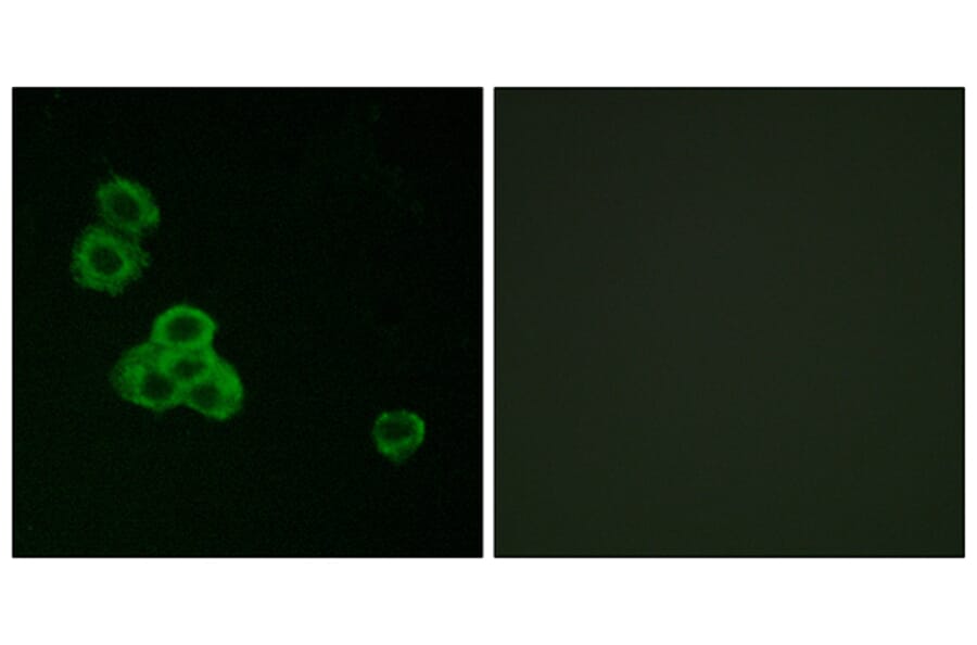 Immunofluorescence - Anti-CaMK2 alpha + delta Antibody (B7033) - Antibodies.com