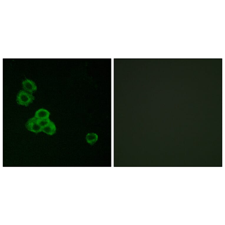 Immunofluorescence - Anti-CaMK2 alpha + delta Antibody (B7033) - Antibodies.com
