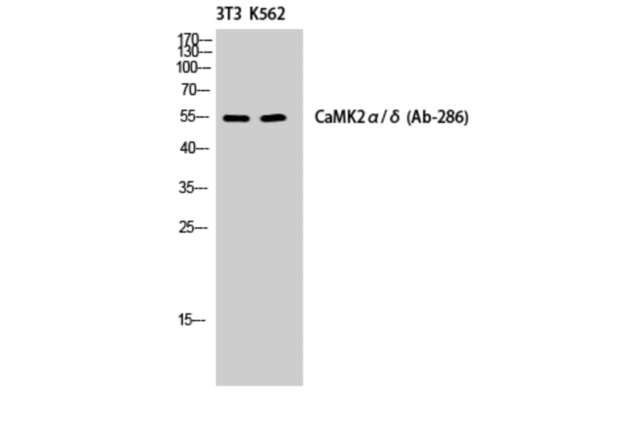 Western Blot - Anti-CaMK2 alpha + delta Antibody (B7033) - Antibodies.com