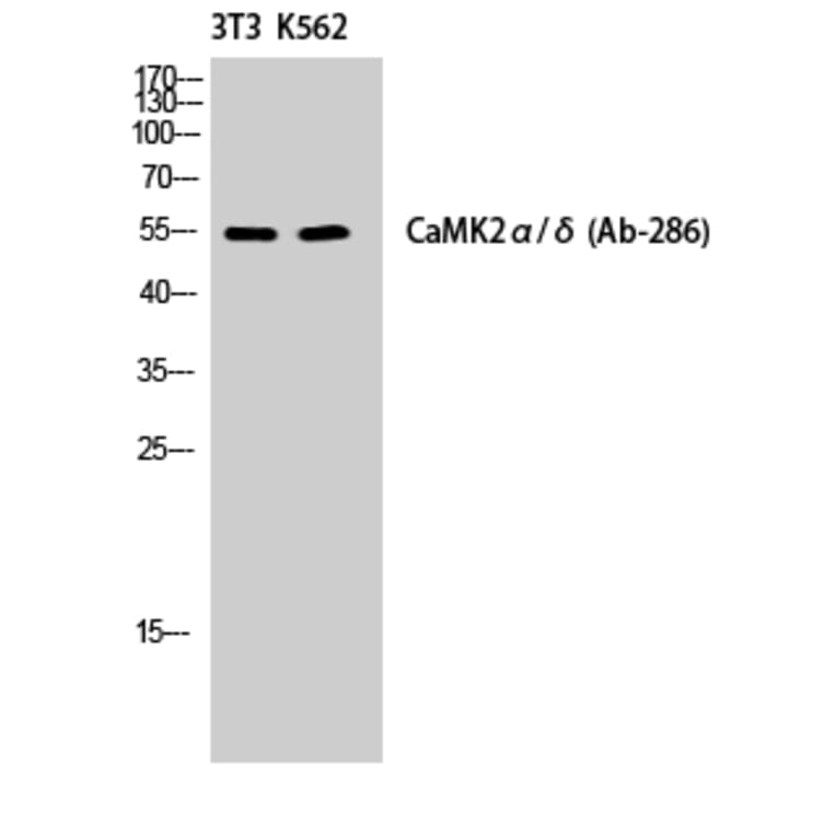 Western Blot - Anti-CaMK2 alpha + delta Antibody (B7033) - Antibodies.com