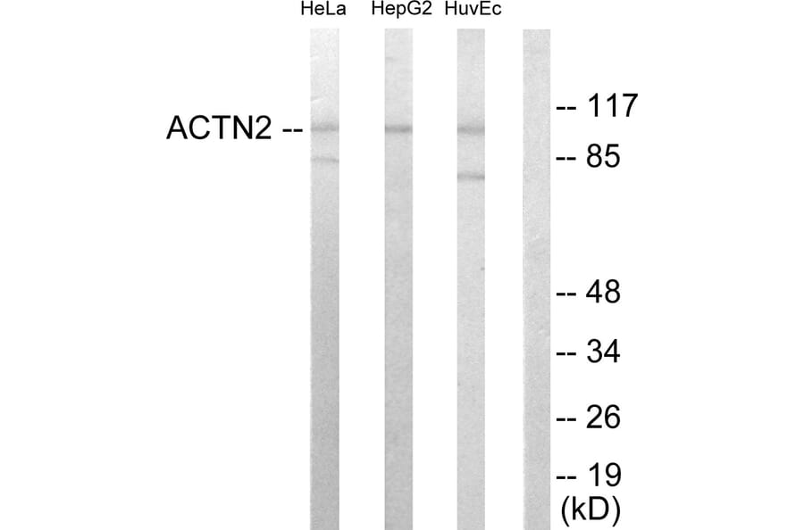 Western Blot - Anti-alpha Actinin 2 + 3 Antibody (C10558) - Antibodies.com
