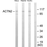 Western Blot - Anti-alpha Actinin 2 + 3 Antibody (C10558) - Antibodies.com