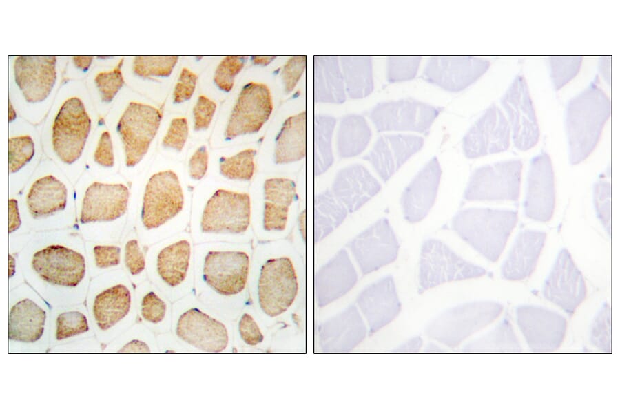 Immunohistochemistry - Anti-alpha Actinin 2 + 3 Antibody (C10558) - Antibodies.com