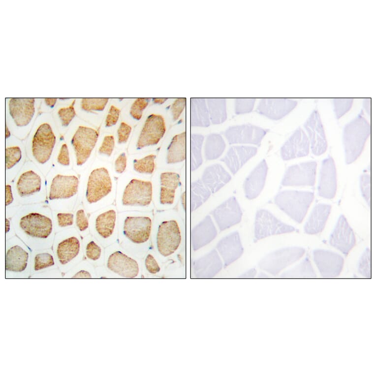 Immunohistochemistry - Anti-alpha Actinin 2 + 3 Antibody (C10558) - Antibodies.com