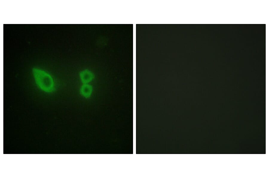 Immunofluorescence - Anti-alpha Actinin 2 + 3 Antibody (C10558) - Antibodies.com