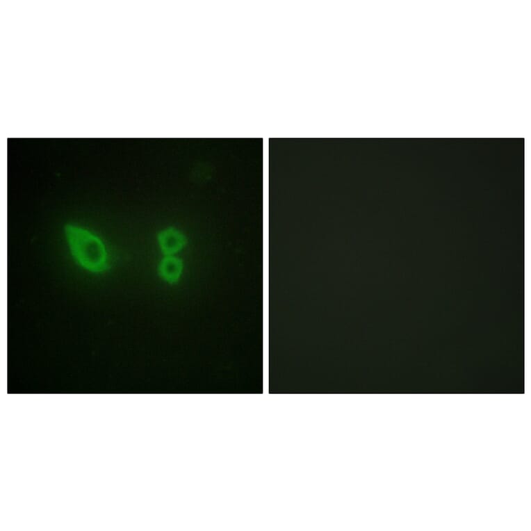 Immunofluorescence - Anti-alpha Actinin 2 + 3 Antibody (C10558) - Antibodies.com
