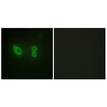 Immunofluorescence - Anti-alpha Actinin 2 + 3 Antibody (C10558) - Antibodies.com