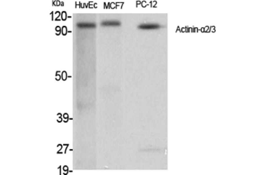 Western Blot - Anti-alpha Actinin 2 + 3 Antibody (C10558) - Antibodies.com