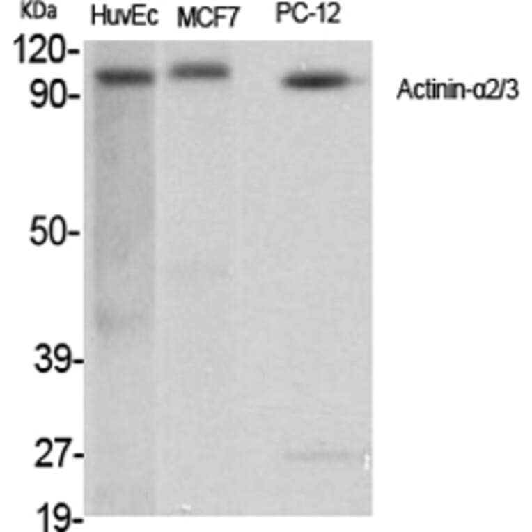 Western Blot - Anti-alpha Actinin 2 + 3 Antibody (C10558) - Antibodies.com