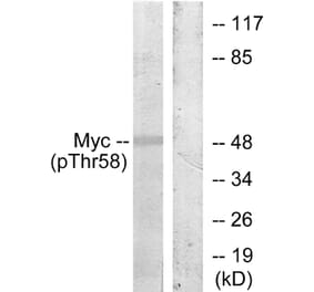Western Blot - Anti-Myc (phospho Thr58) Antibody (A7159) - Antibodies.com