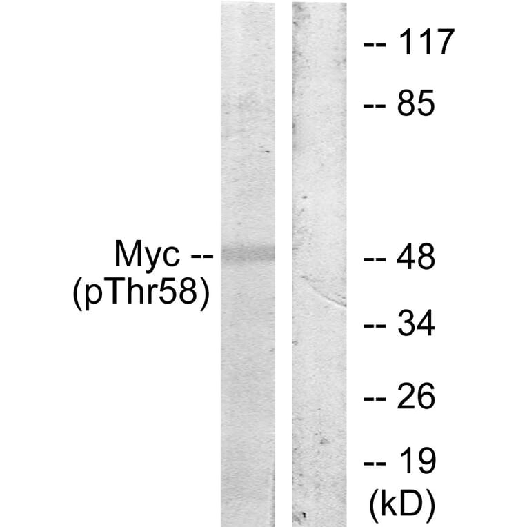 Western Blot - Anti-Myc (phospho Thr58) Antibody (A7159) - Antibodies.com